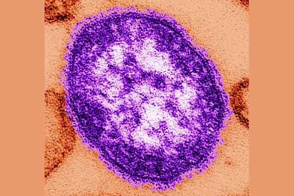 Thin-section transmission electron micrograph (TEM) reveals a single virus particle, or virion, of measles virus. Measles is one of the most highly contagious diseases. Photo courtesy of Cynthia Goldsmith, CDC