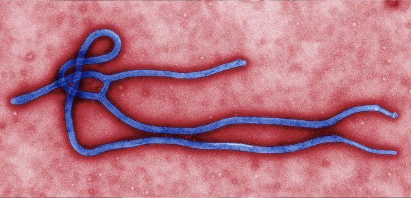 Ebola Virus. Image courtesy CDC Formaspace-Ebola-Virus-colorized-TEM